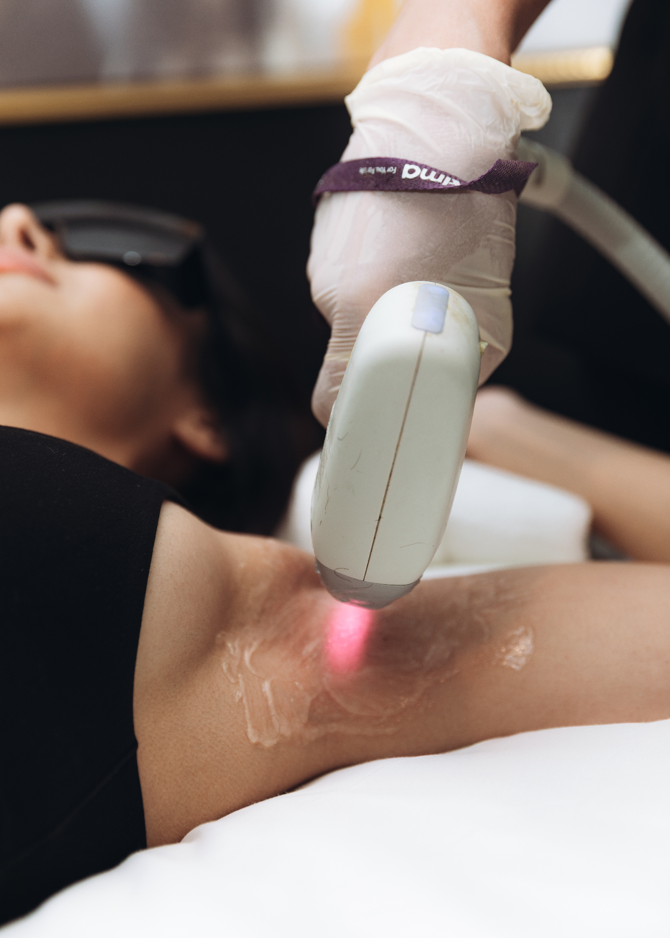 Underarm laser hair removal treatment at HBL Spa